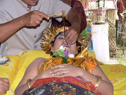 Tooth Filing 3 Tooth Filing 3